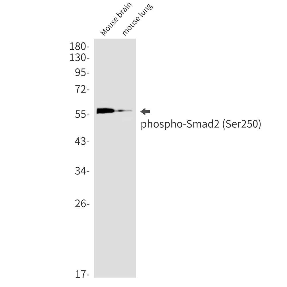 Rabbit Monoclonal Antibody to Phospho-Smad2 (Ser250)