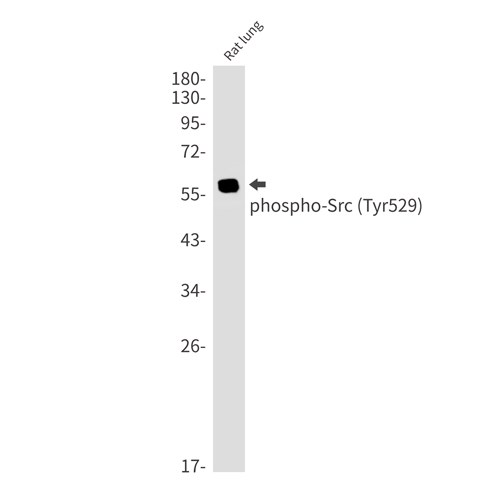 Rabbit Monoclonal Antibody to Phospho-Src (Tyr530)
