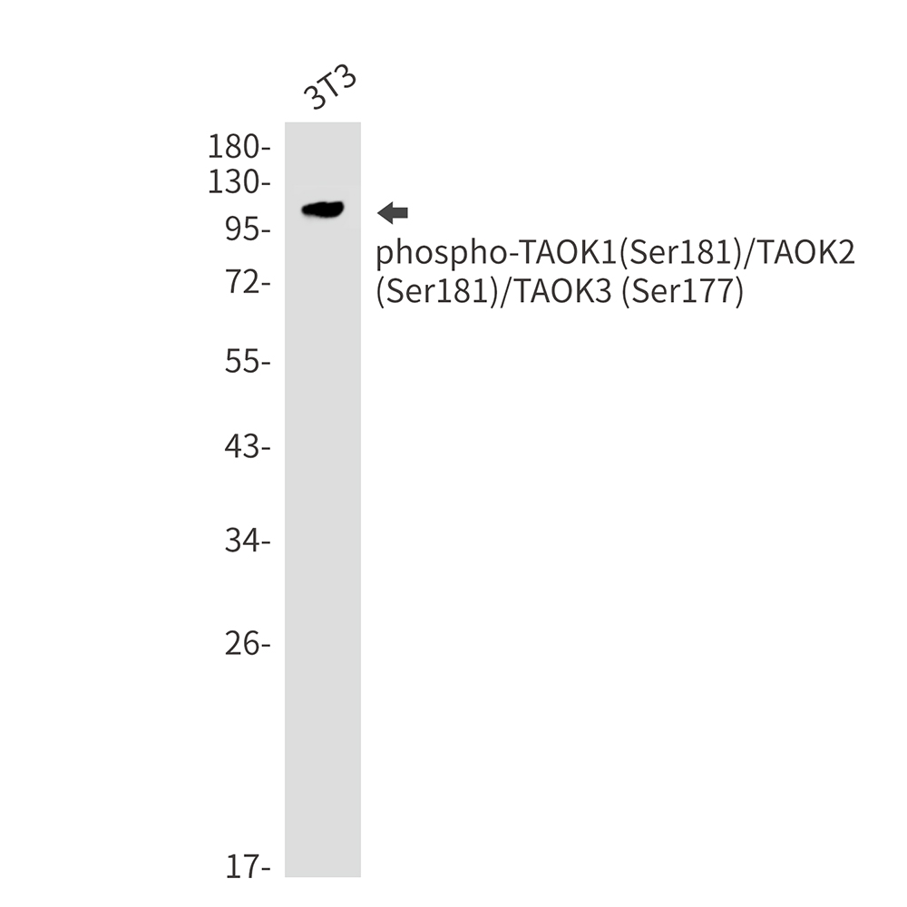 Rabbit Monoclonal Antibody to Phospho-TAOK1/2/3 (Ser181/Ser181/Ser177)