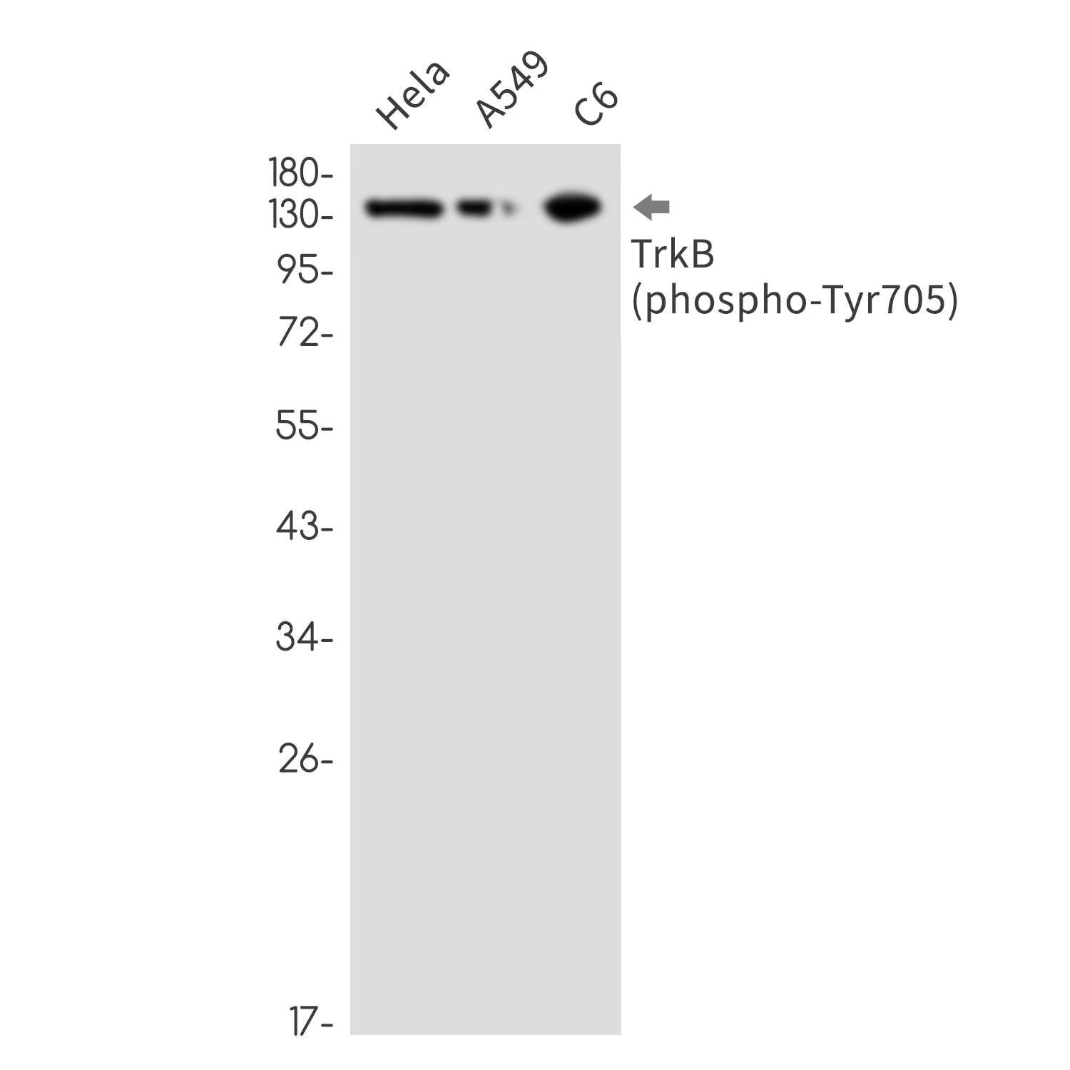 Rabbit Monoclonal Antibody to Phospho-TrkB (Tyr705)