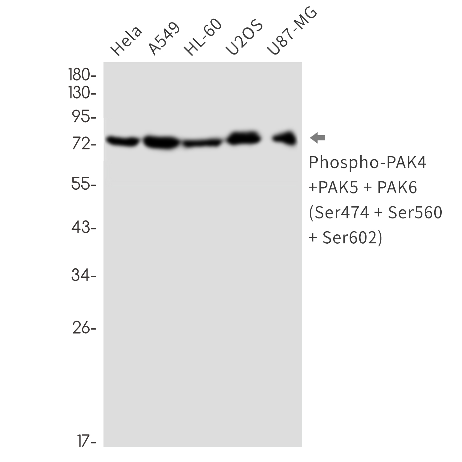 Rabbit Monoclonal Antibody to Phospho-PAK4/5/6 (Ser474/Ser560/Ser602)