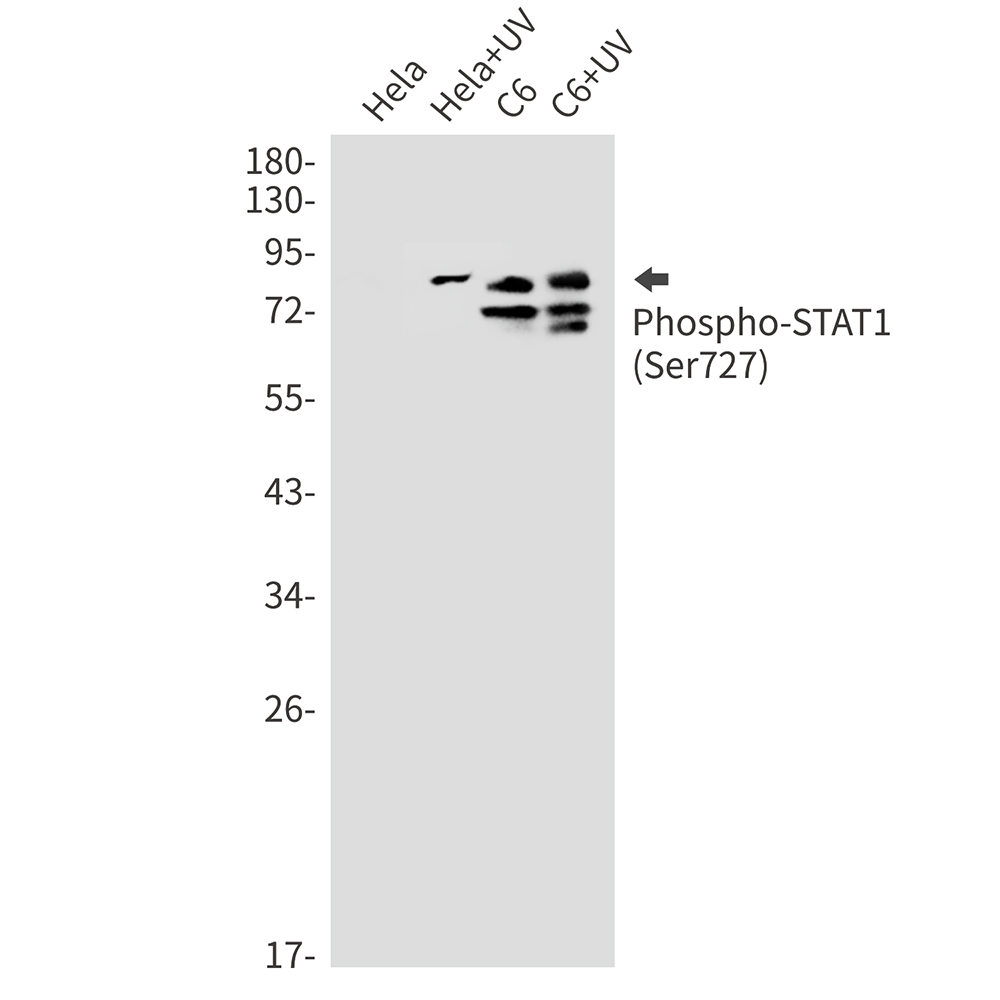 Rabbit Monoclonal Antibody to Phospho-STAT1 (Ser727)