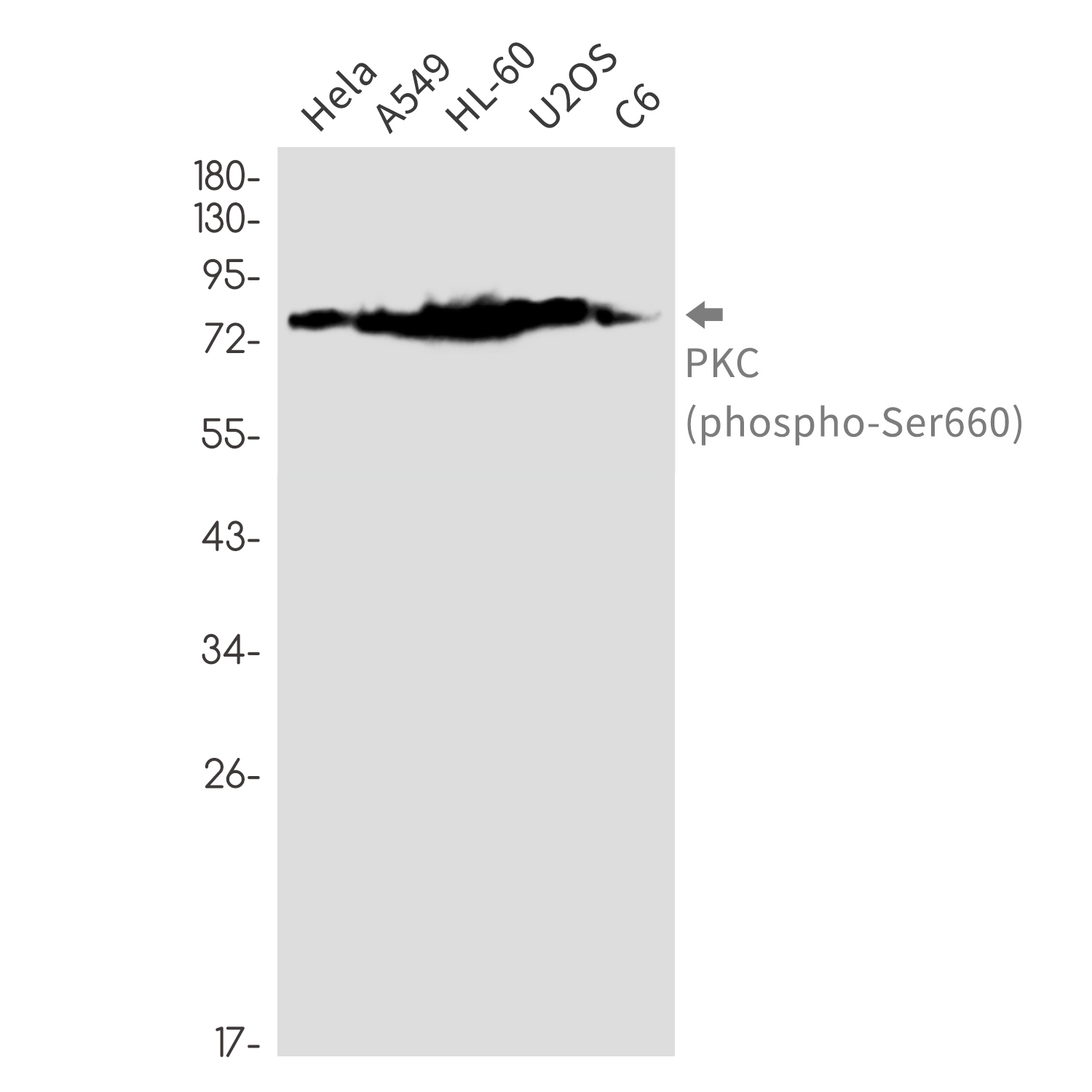 Rabbit Monoclonal Antibody to Phospho-PKC (Ser660)