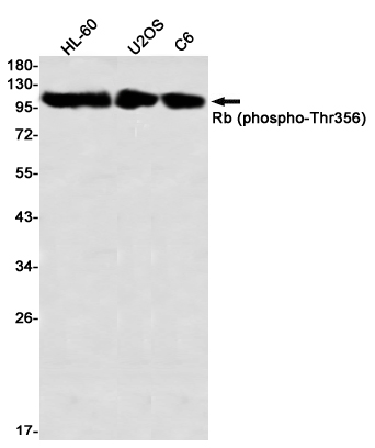 Rabbit Monoclonal Antibody to Phospho-Rb (Thr356)