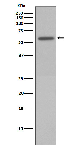 Rabbit Polyclonal Antibody to Phospho-Vimentin (Ser72)