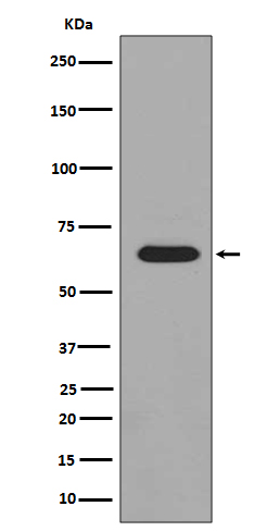 Rabbit Polyclonal Antibody to Phospho-PAK1/2/3 (Ser144/Ser141/Ser154)