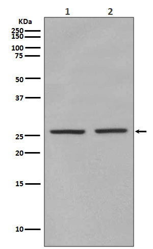 Rabbit Polyclonal Antibody to Phospho-eIF4E (Ser209)