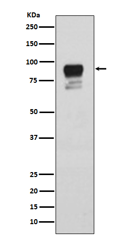 Rabbit Polyclonal Antibody to Phospho-Glycogen Synthase (Ser641)