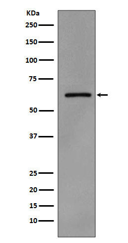 Rabbit Polyclonal Antibody to Phospho-Src (Tyr419)