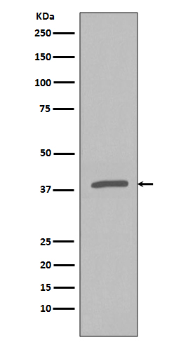 Rabbit Polyclonal Antibody to Phospho-IKB alpha (Ser32)