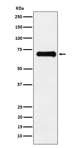 Rabbit Polyclonal Antibody to Phospho-PAK4/5/6 (Ser474/Ser560/Ser602)
