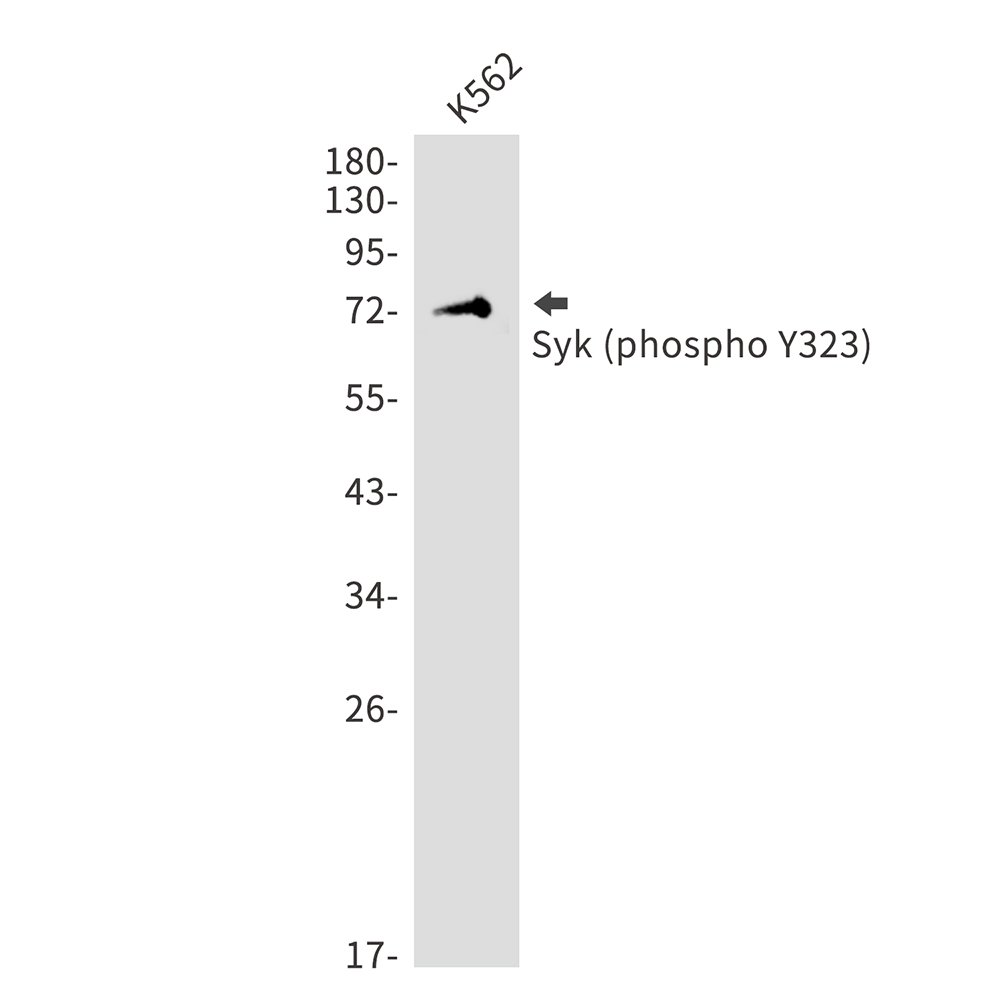 Rabbit Polyclonal Antibody to Phospho-Syk (Tyr323)