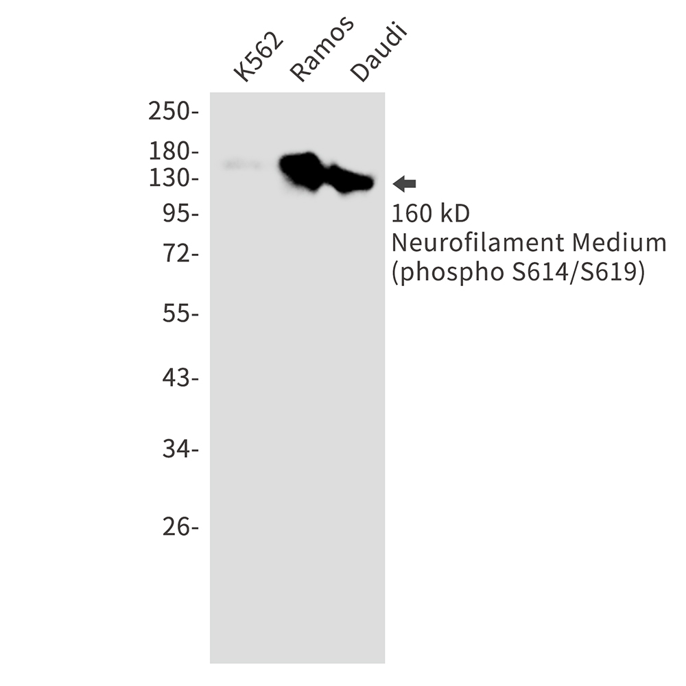 Rabbit Polyclonal Antibody to Phospho-Neurofilament Medium (Ser614/Ser619)