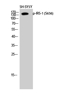 Rabbit Polyclonal Antibody to Phospho-IRS1 (Ser636)