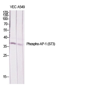 Rabbit Polyclonal Antibody to Phospho-JunD (Ser73/100)