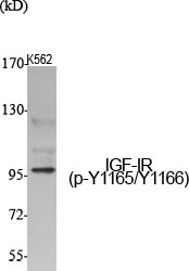 Rabbit Polyclonal Antibody to Phospho-IGF1 Receptor (Tyr1165/Tyr1166)