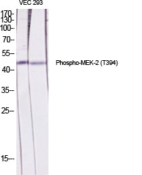 Rabbit Polyclonal Antibody to Phospho-MEK2 (Thr394)