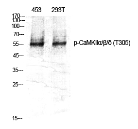 Rabbit Polyclonal Antibody to Phospho-CaMKII (Thr305)