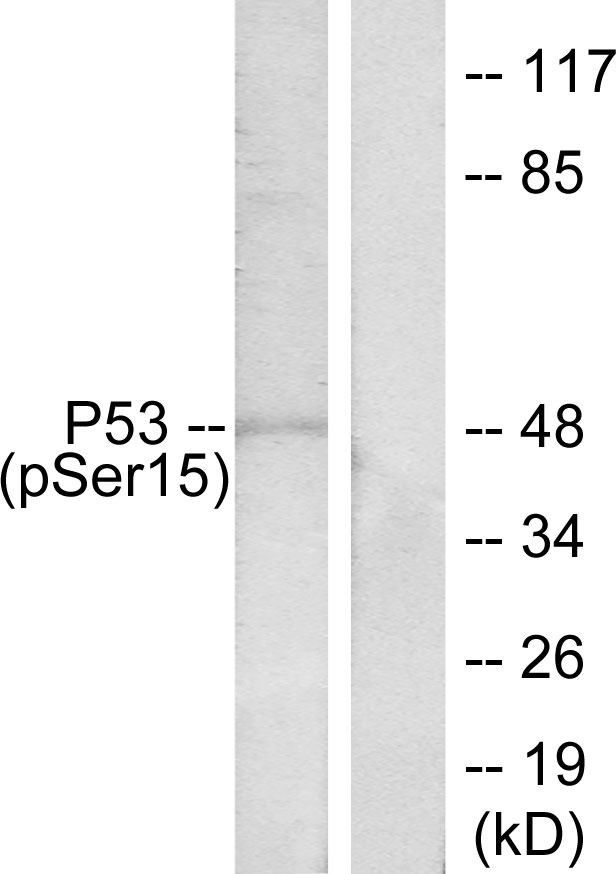 Rabbit Polyclonal Antibody to Phospho-p53 (Ser15)