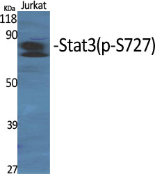 Rabbit Polyclonal Antibody to Phospho-STAT3 (Ser727)