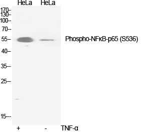 Rabbit Polyclonal Antibody to Phospho-NF-KB p65 (Ser536)