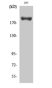 Rabbit Polyclonal Antibody to Phospho-IRS1 (Ser639)