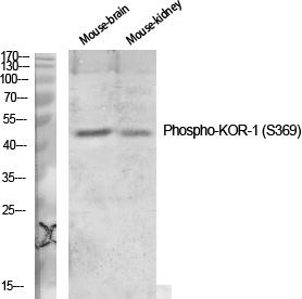 Rabbit Polyclonal Antibody to Phospho-kappa Opioid Receptor (Ser369)