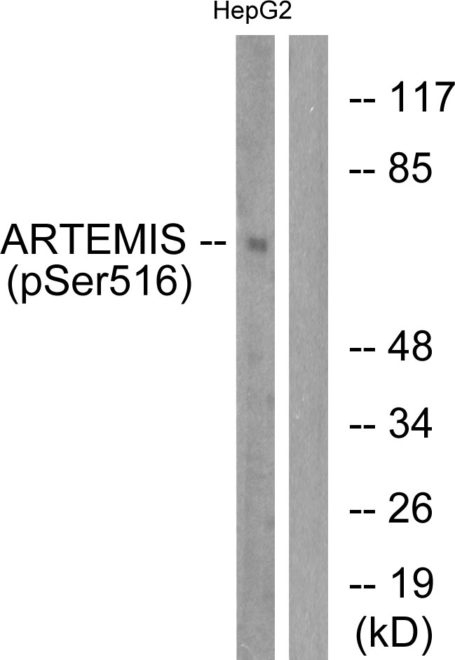 Rabbit Polyclonal Antibody to Phospho-Artemis (Ser516)