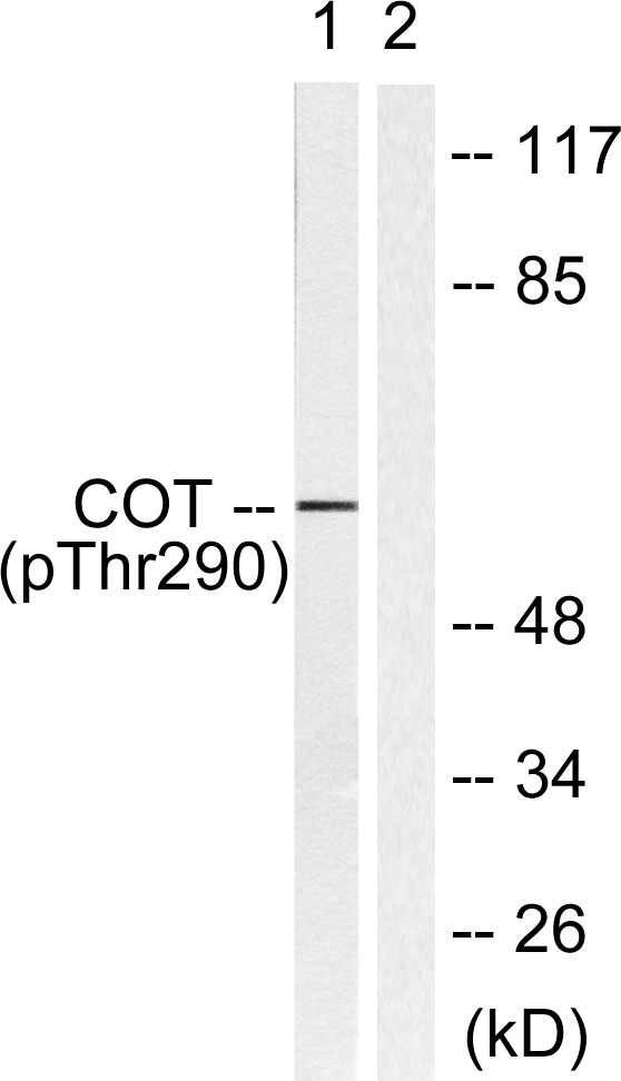 Rabbit Polyclonal Antibody to Phospho-COT (Thr290)