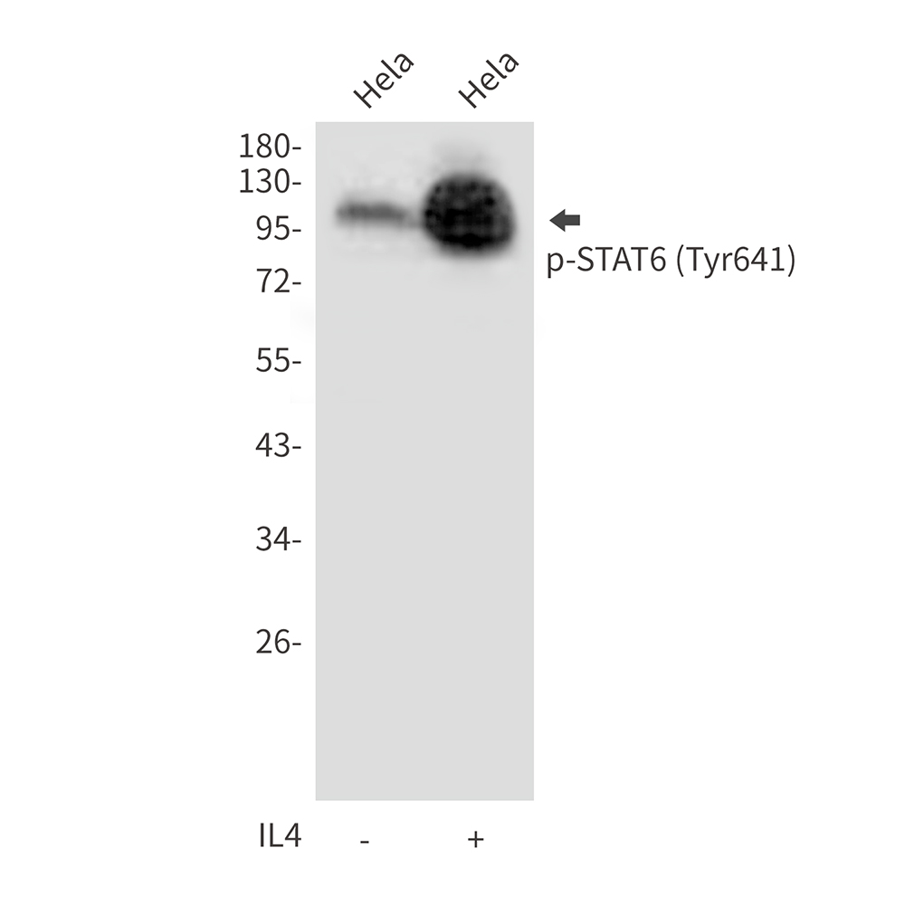Rabbit Polyclonal Antibody to Phospho-STAT6 (Tyr641)