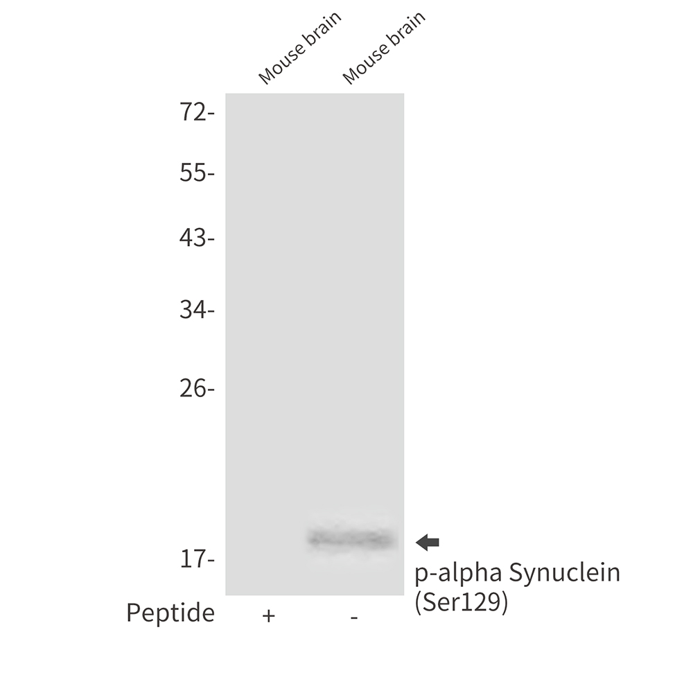 Rabbit Polyclonal Antibody to Phospho-alpha Synuclein (Ser129)