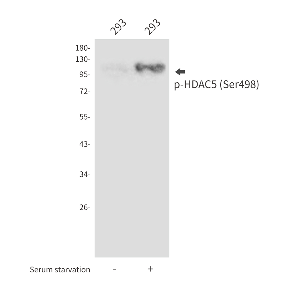 Rabbit Polyclonal Antibody to Phospho-HDAC5 (Ser498)