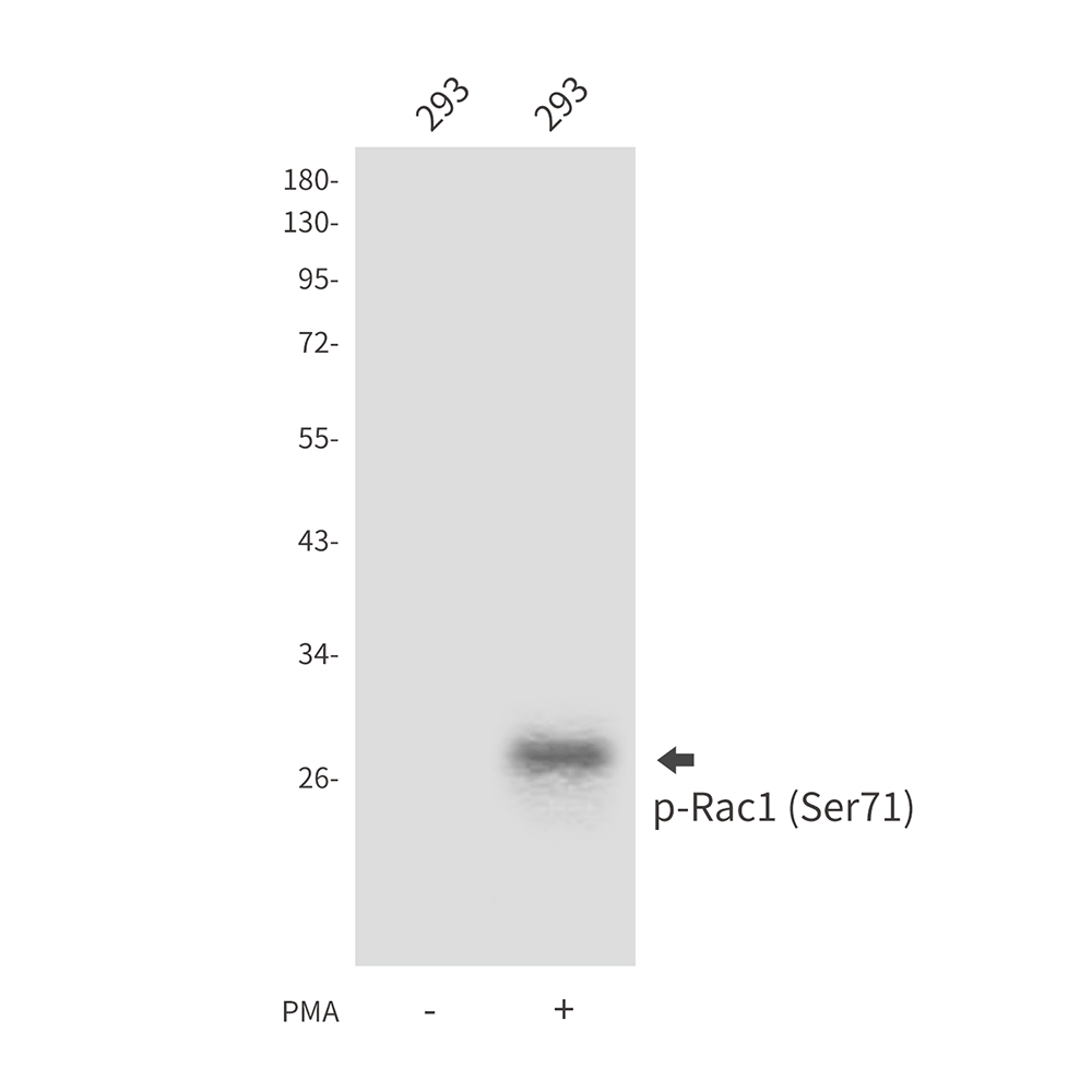 Rabbit Polyclonal Antibody to Phospho-Rac1 (Ser71)
