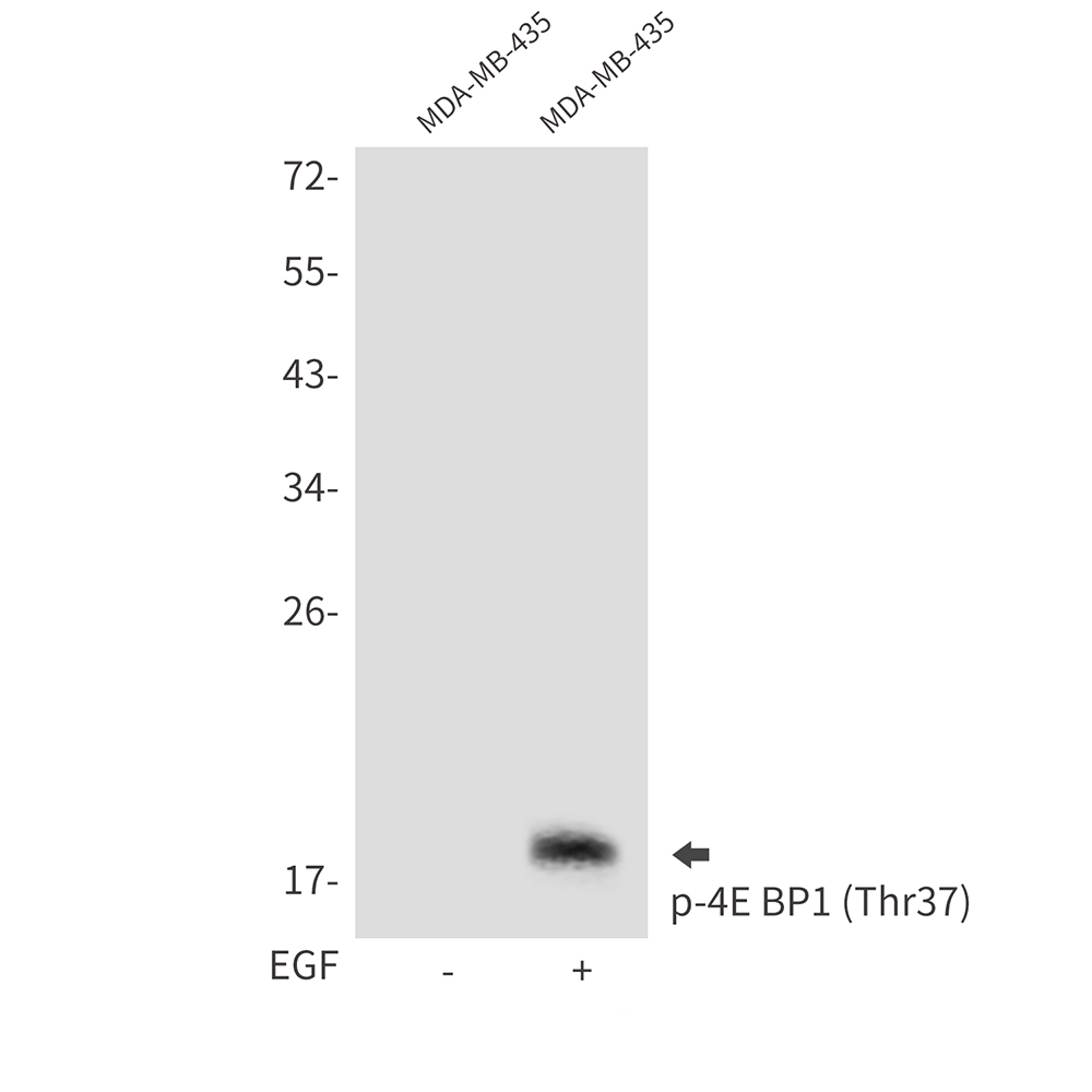 Rabbit Polyclonal Antibody to Phospho-4E BP1 (Thr37)