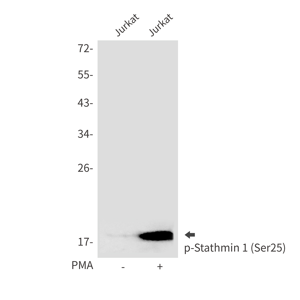 Rabbit Polyclonal Antibody to Phospho-Stathmin 1 (Ser25)