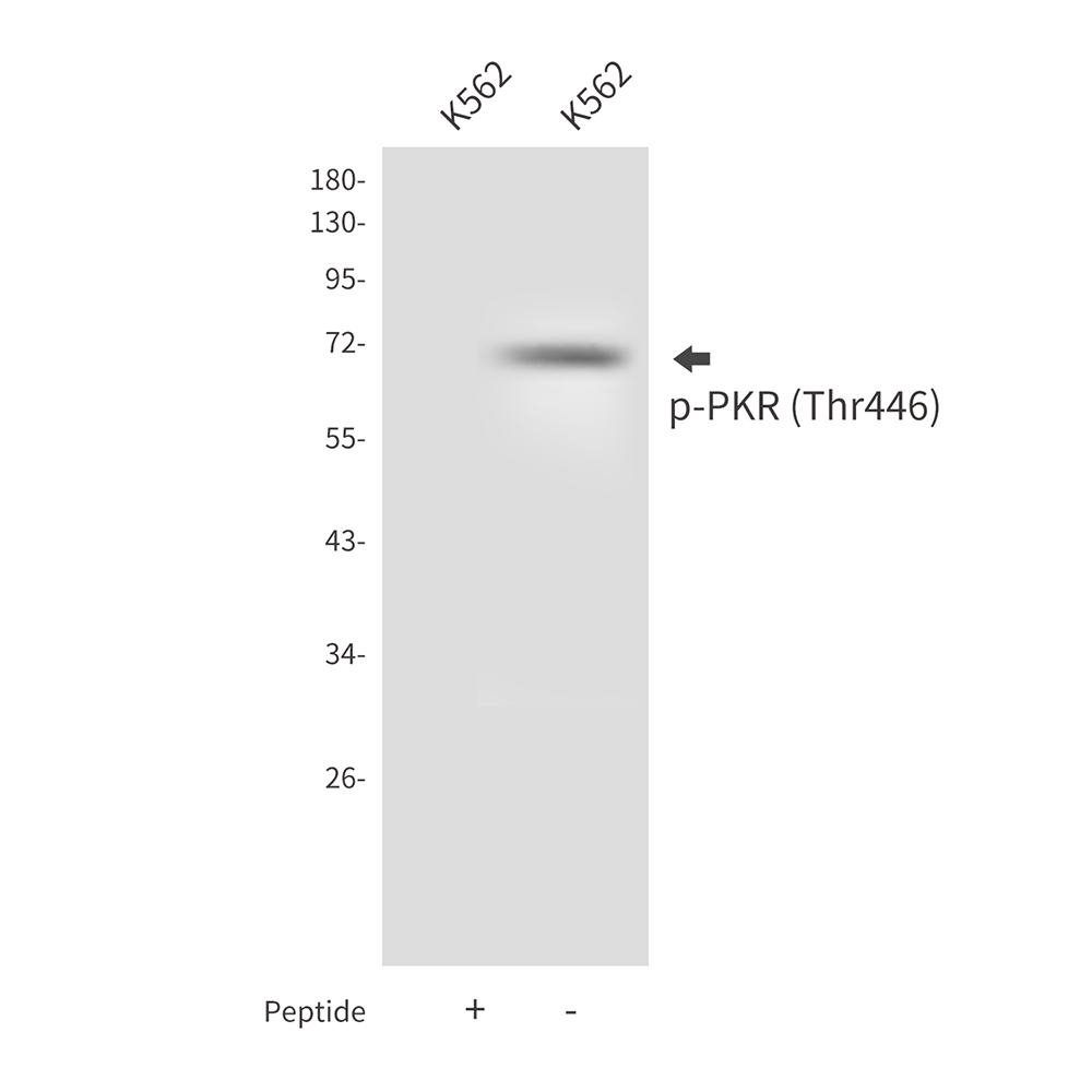 Rabbit Polyclonal Antibody to Phospho-PKR (Thr446)