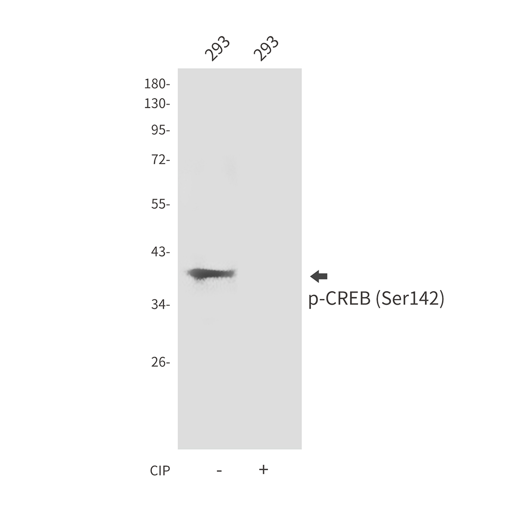 Rabbit Polyclonal Antibody to Phospho-CREB (Ser142)