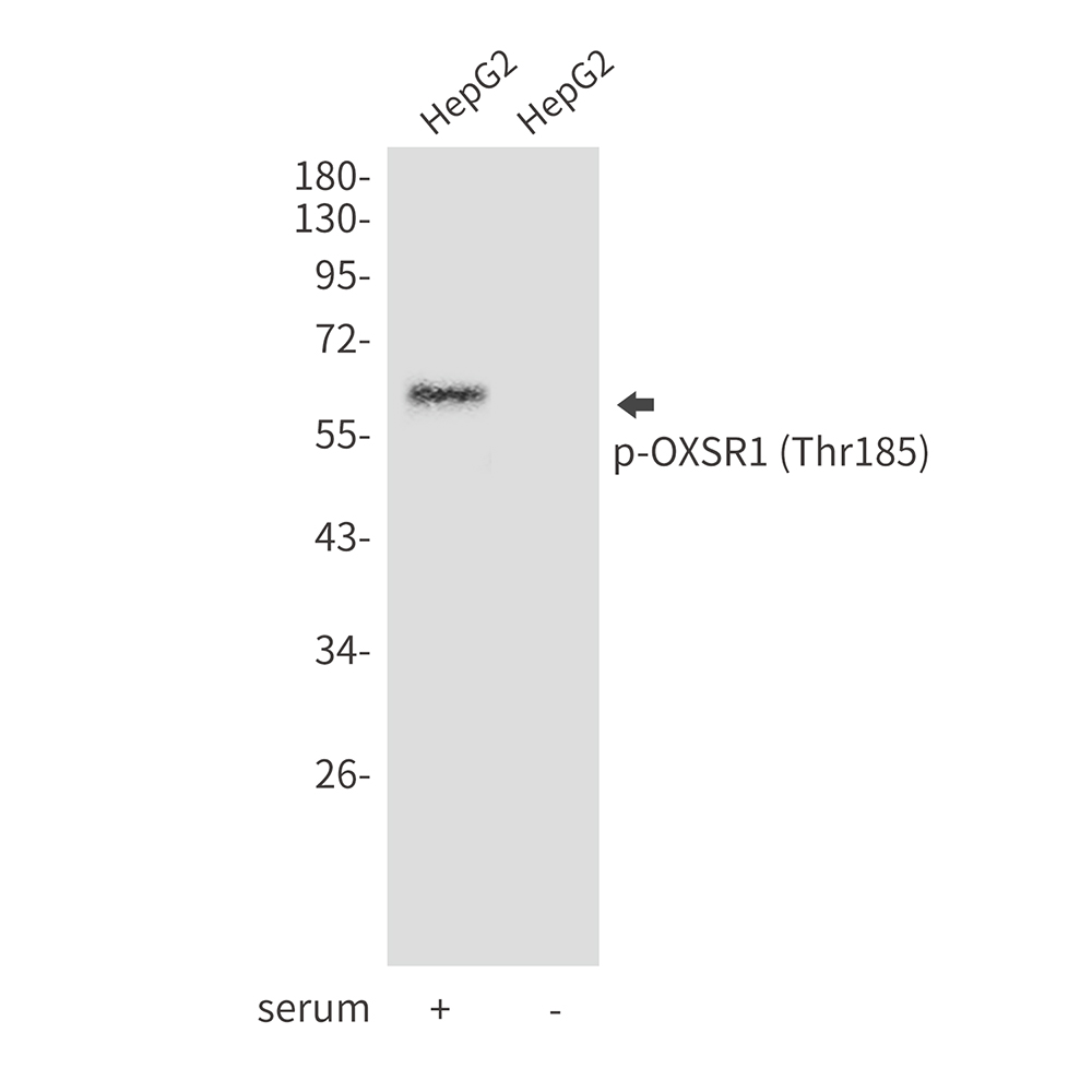 Rabbit Polyclonal Antibody to Phospho-OXSR1 (Thr185)