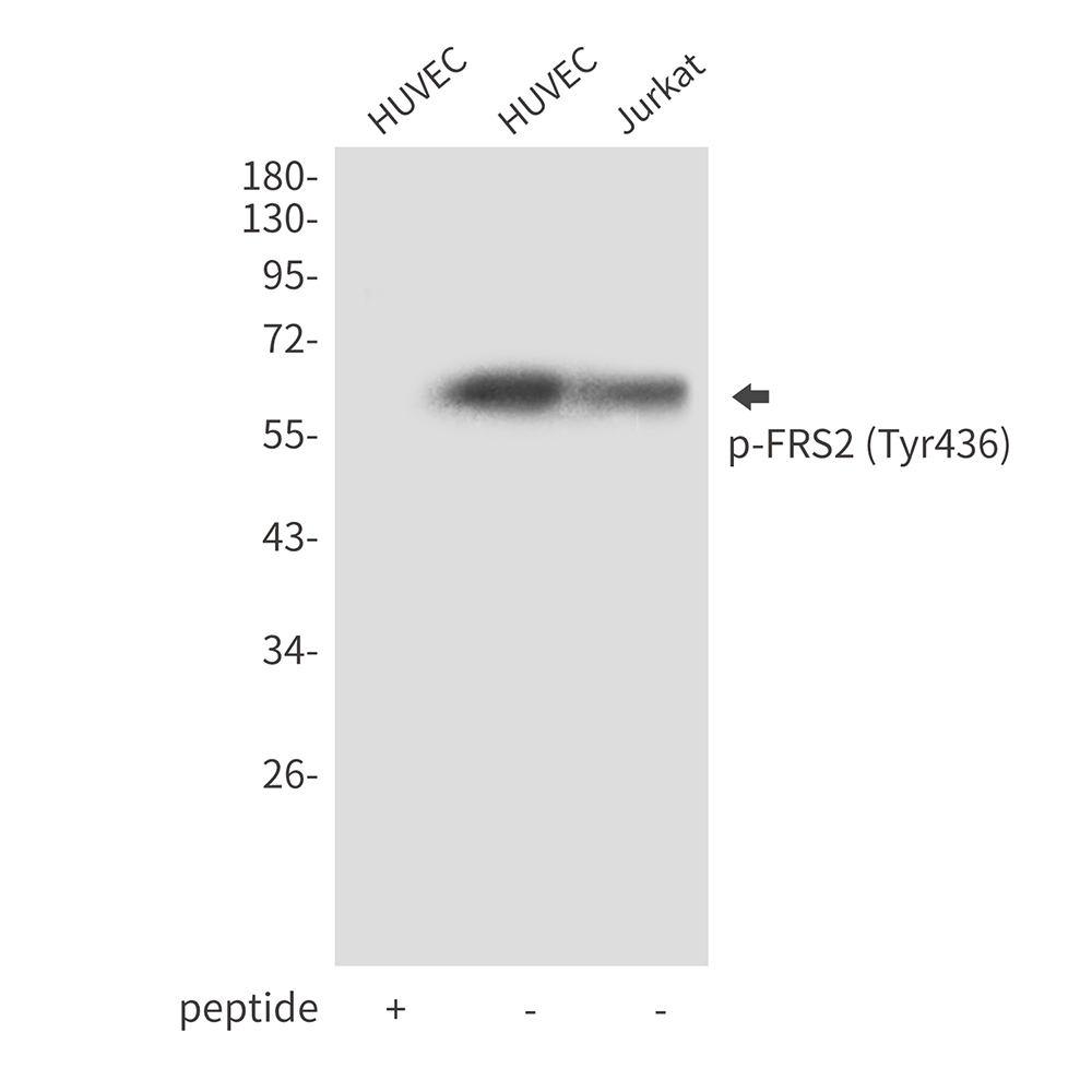 Rabbit Polyclonal Antibody to Phospho-FRS2 (Tyr436)