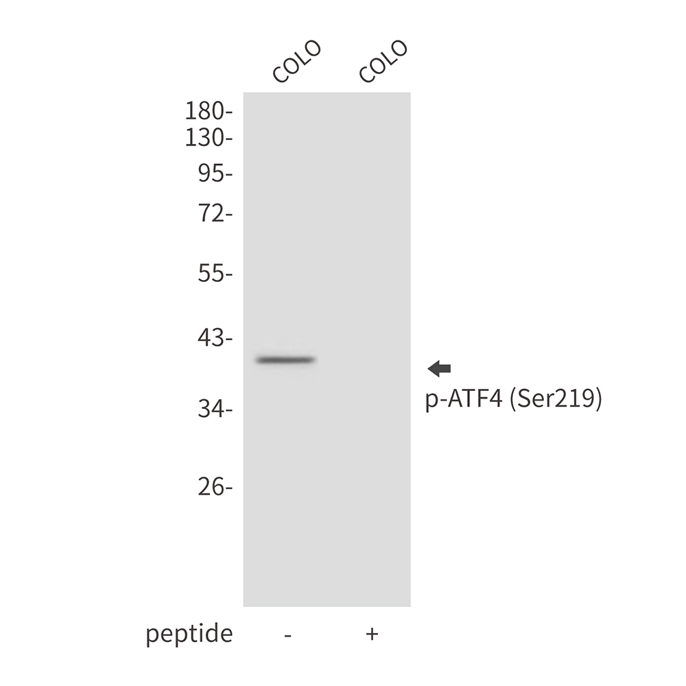 Rabbit Polyclonal Antibody to Phospho-ATF4 (Ser219)