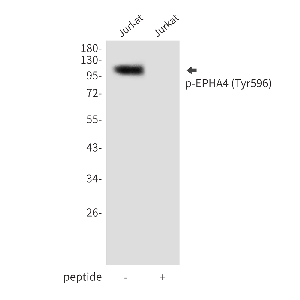 Rabbit Polyclonal Antibody to Phospho-EPHA4 (Tyr596)