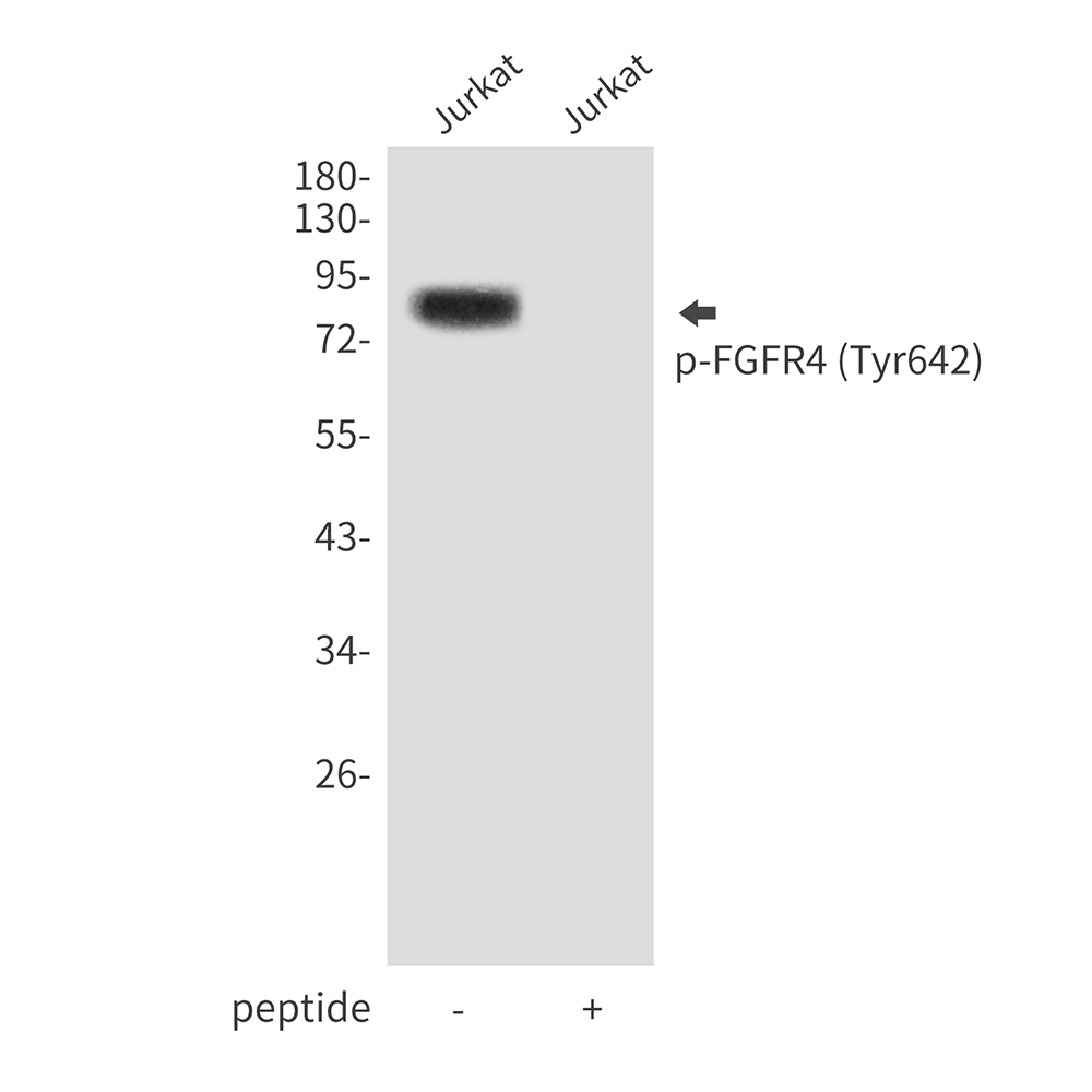 Rabbit Polyclonal Antibody to Phospho-FGFR4 (Tyr642)