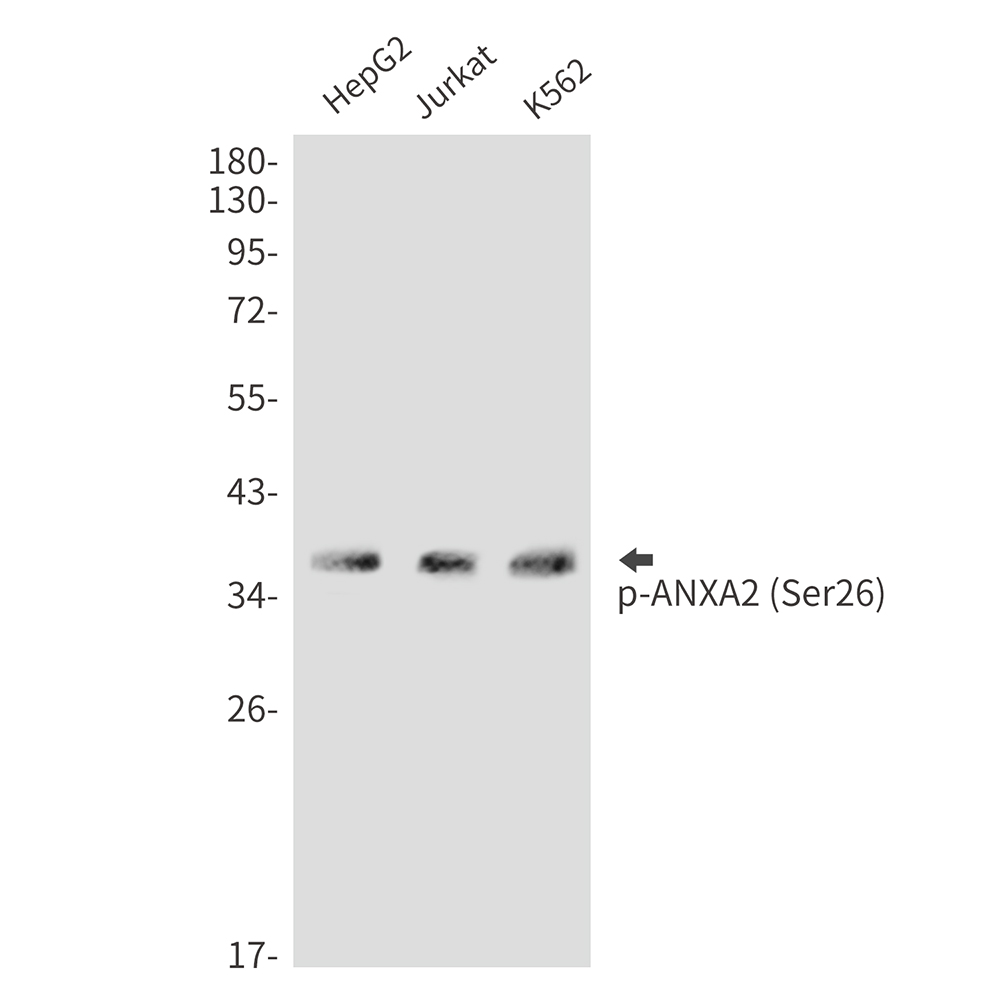 Rabbit Polyclonal Antibody to Phospho-Annexin 2 (Ser26)