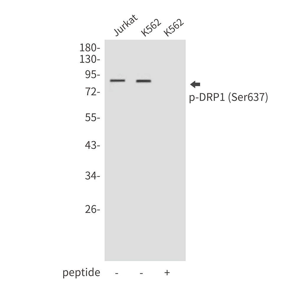 Rabbit Polyclonal Antibody to Phospho-DRP1 (Ser637)