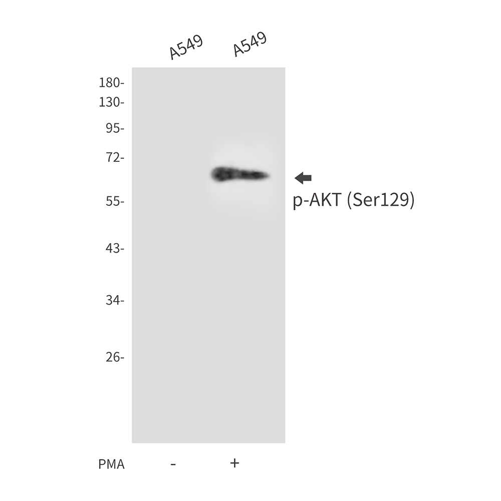 Rabbit Polyclonal Antibody to Phospho-AKT (Ser129)