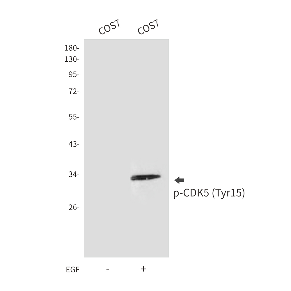 Rabbit Polyclonal Antibody to Phospho-CDK5 (Tyr15)