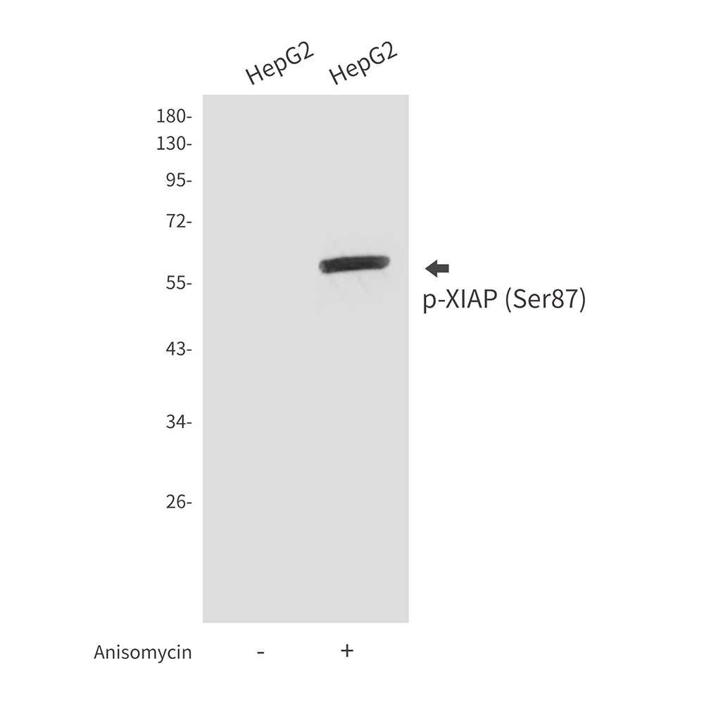 Rabbit Polyclonal Antibody to Phospho-XIAP (Ser87)
