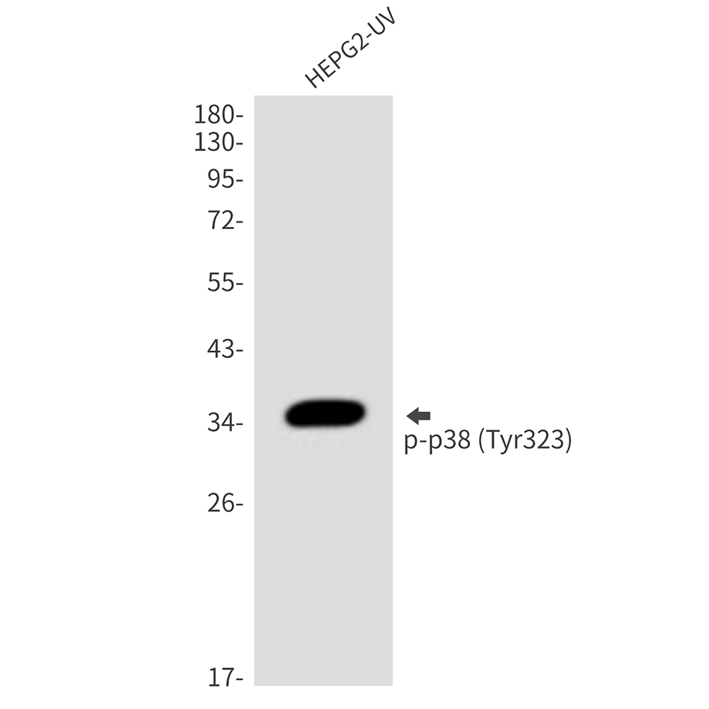 Rabbit Polyclonal Antibody to Phospho-p38 (Tyr323)