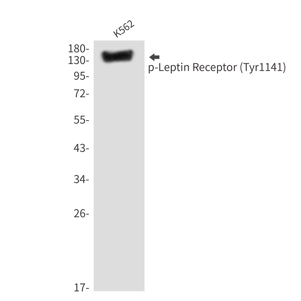 Rabbit Polyclonal Antibody to Phospho-Leptin Receptor (Tyr1141)