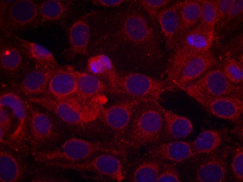 Rabbit Polyclonal Antibody to Phospho-VEGF Receptor 2 (Tyr1175)